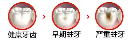 营口孩子牙齿龋坏补牙疼不疼